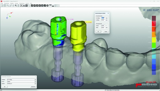 [875.1462] Magic® Model 3D Implant